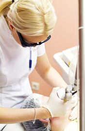 Ārsts veic fototermolīzes procedūru